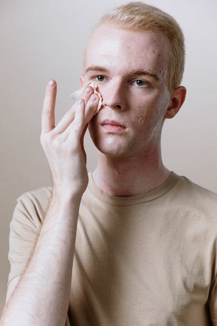 The Adult Acne Morning Routine (4 Steps)